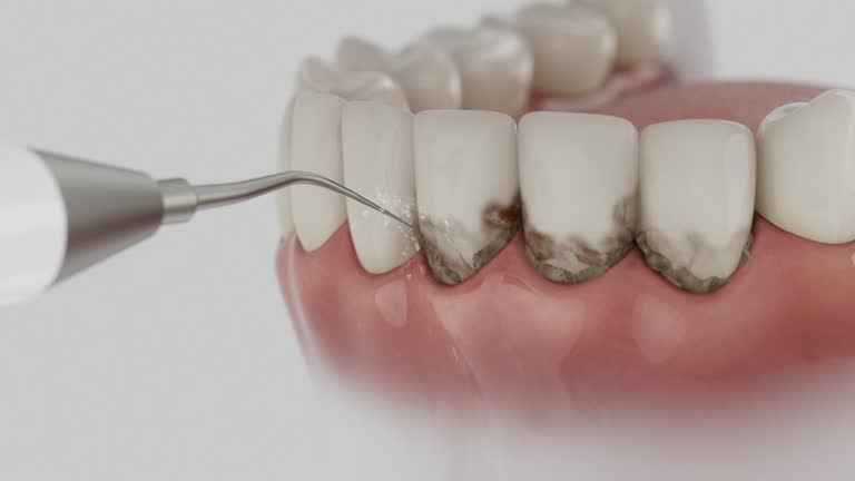 Reliable Dental Implants contractor in Irondale, GA by Smile Center Dentistry
